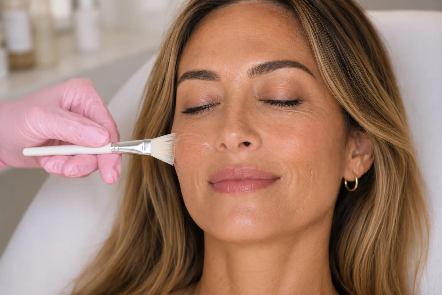 Chemical peel treatment at Englewood Cosmetic Medical Spa in Englewood, NJ
